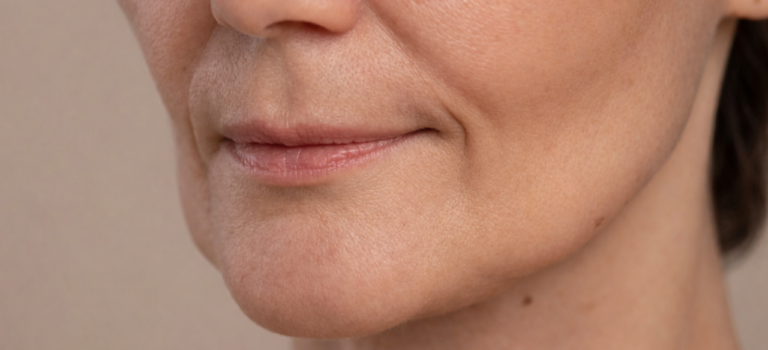 Cara Mencegah Penuaan Dini pada Kulit Wajah